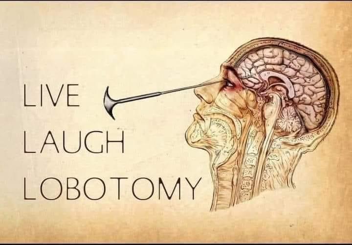 U8 LOBOTOMY