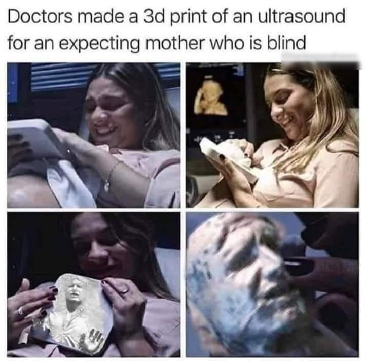 Doctors made a 3d print of an ultrasound for an expecting mother who is blind