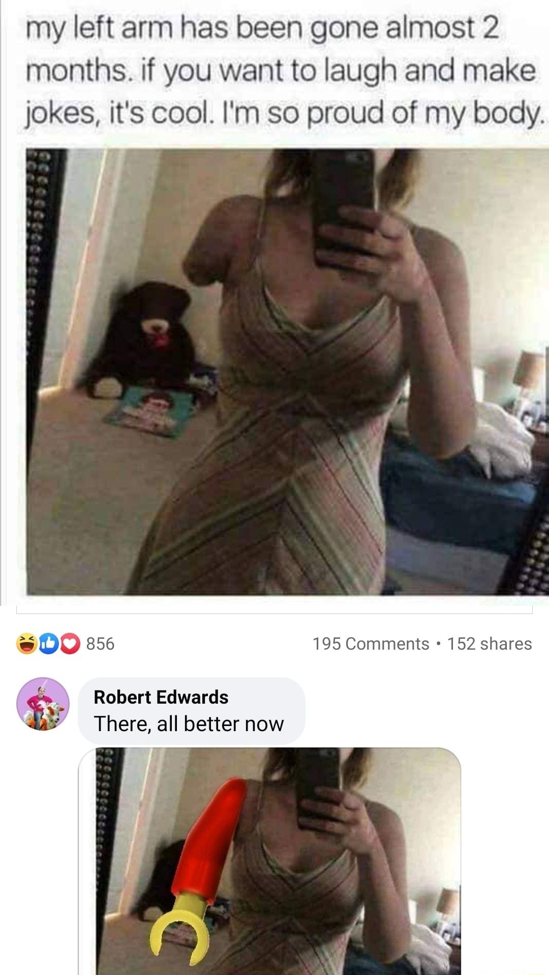 my left arm has been gone almost 2 months if you want to laugh and make jokes its cool Im so proud of my body D0 856 195 Comments 152 shares s Robert Edwards There all better now