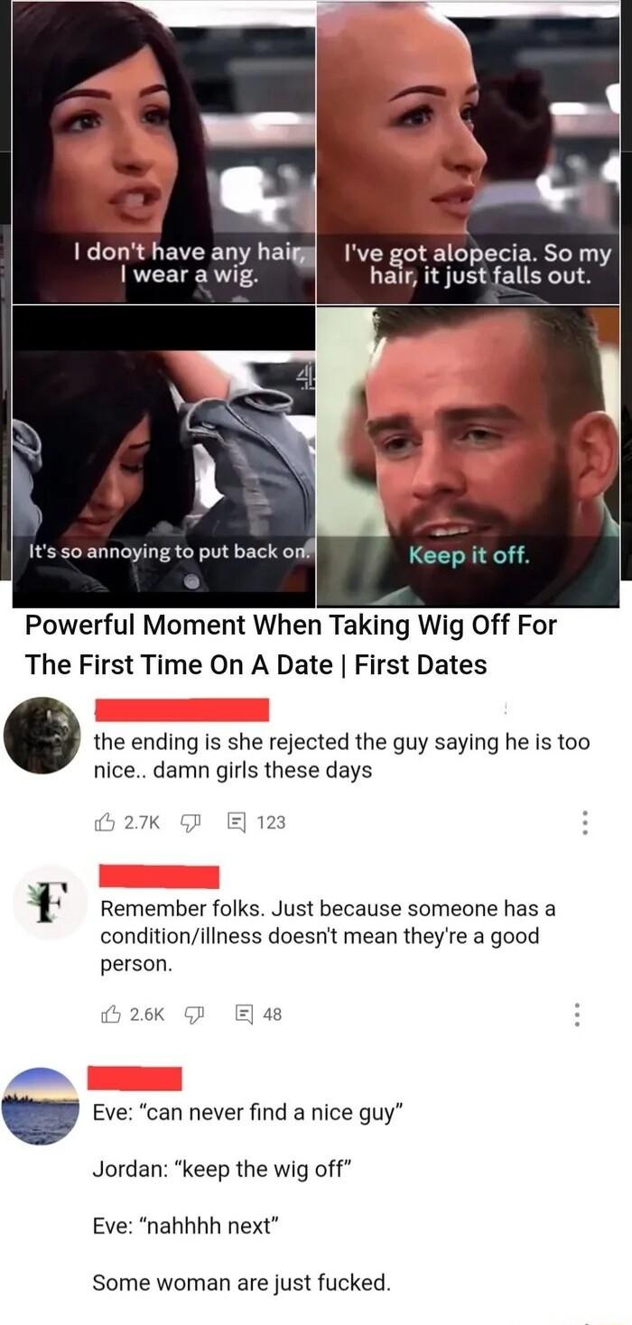 I dont have any haiggl Ive got alopecia So my wear a wig halr it justfalls out Its s annoying to put back onf Powerful Moment When Taking Wig Off For The First Time On A Date First Dates the ending is she rejected the guy saying he is too nice damn girls these days 27 123 Remember folks Just because someone has a conditionillness doesnt mean theyre a good person 2 6K 48 Eve can never find a nice g