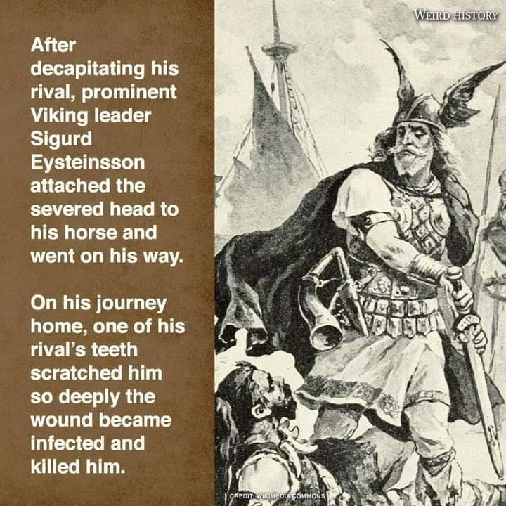 After decapitating his rival prominent Viking leader Sigurd SECLELLL ELELERRUT severed head to his horse and went on his way On his journey home one of his rivals teeth scratched him s0 deeply the wound became infected and killed him