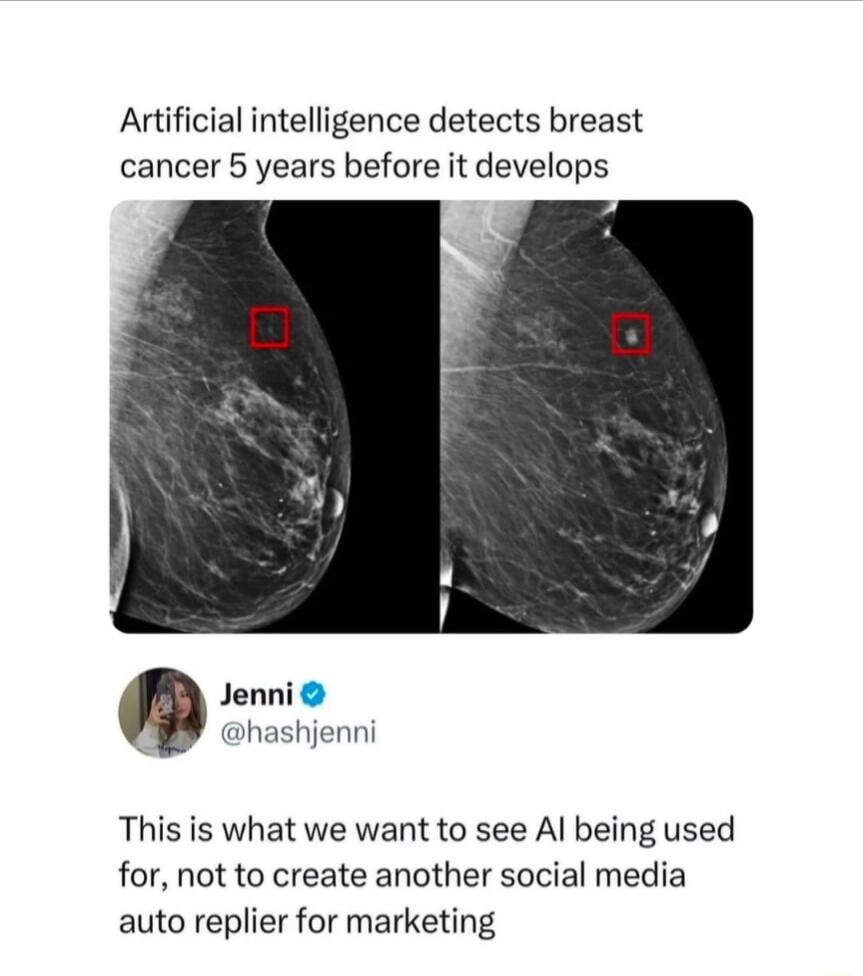 Artificial intelligence detects breast cancer 5 years before it develops This is what we want to see Al being used for not to create another social media auto replier for marketing