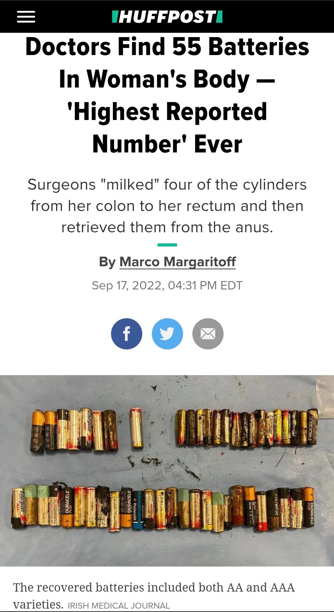 Doctors Find 55 Batteries In Womans Body Highest Reported Number Ever Surgeons milked four of the cylinders from her colon to her rectum and then retrieved them from the anus By Marco Margaritoff Sep 172022 0431 PM EDT 000 The recovered batteries included both AA and AAA varieties IRISH MEDICAL JOURNAL