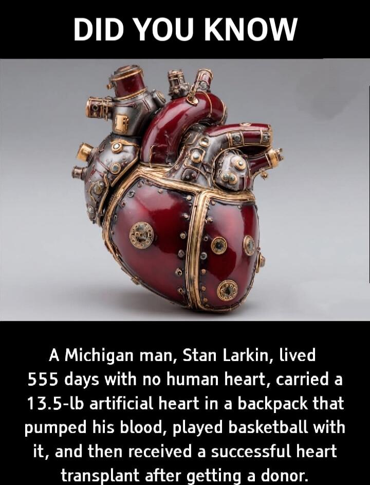 DID YOU KNOW A Michigan man, Stan Larkin, lived 555 days with no human heart, carried a 13.5-lb artificial heart in a backpack that pumped his blood, played basketball with it, and then received a successful heart transplant after getting a donor.