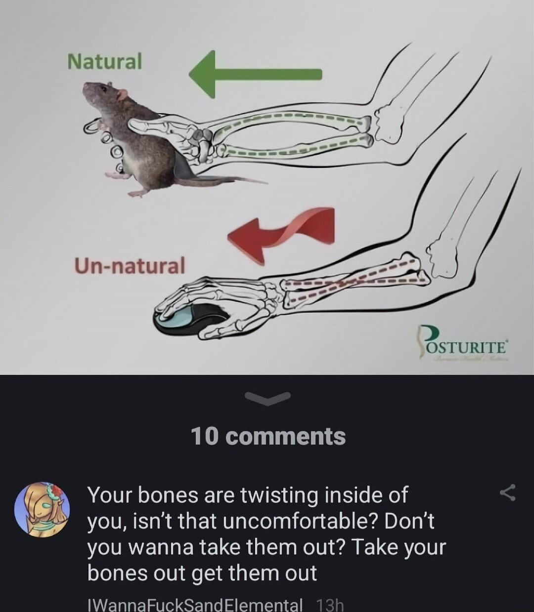 2 OSTURITE 10 comments Your bones are twisting inside of you isnt that uncomfortable Dont you wanna take them out Take your bones out get them out