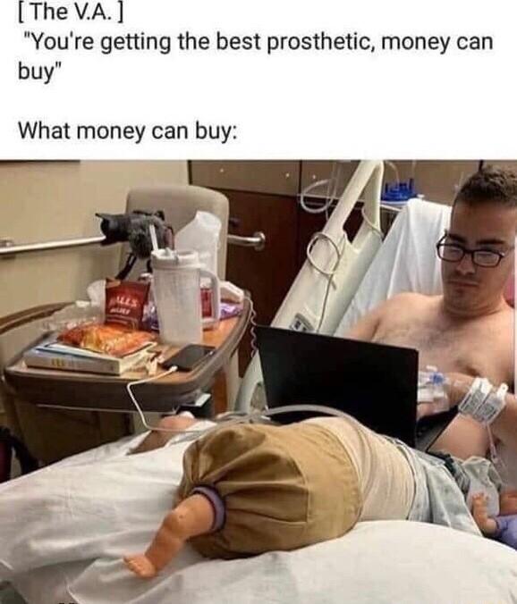 TheVA Youre getting the best prosthetic money can buy What money can buy