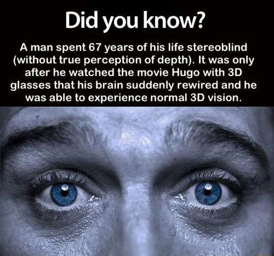 Did you know A man spent 67 years of his life stereoblind without true perception of depth It was only Y CI CRVETCL T RO TN VTR TR R IEEEEER G RN TR TR G ER VRSV TG D T N 1Y UEEELIERGEDGENEL LG Ly BT D RVELD N