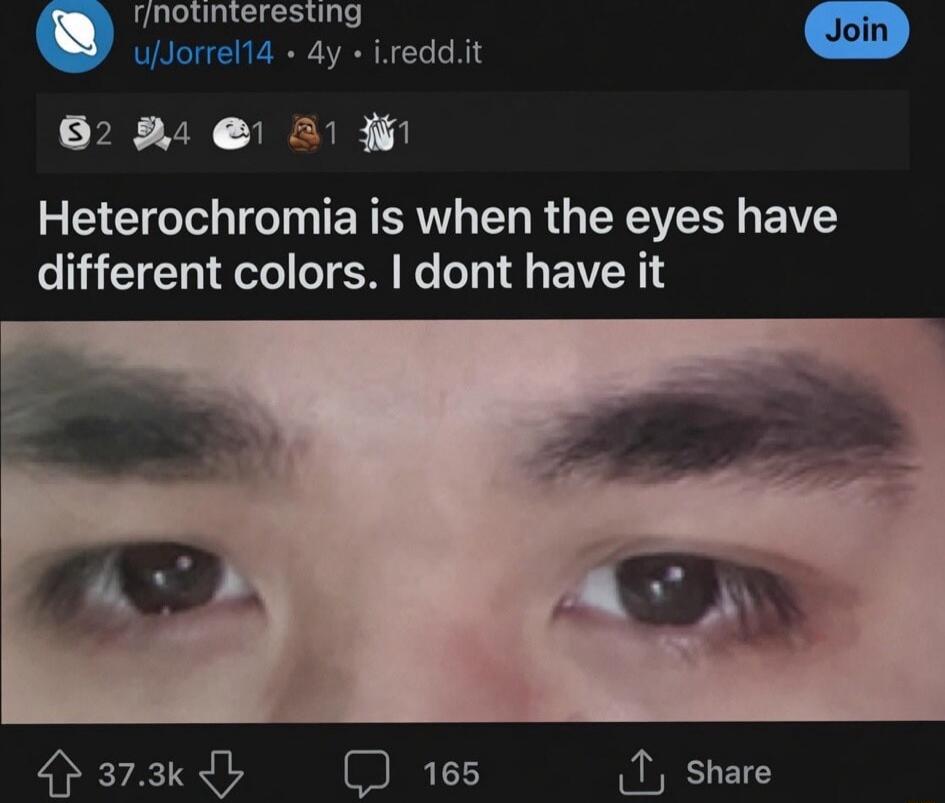 Heterochromia is when the eyes have different colors. I don't have it