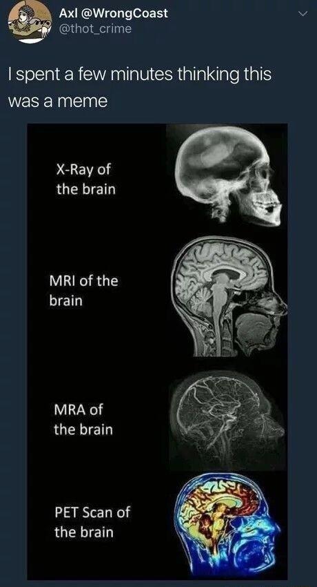 Axl WrongCoast thot_crime spent a few minutes thinking this was a meme X Ray of the brain MRI of the brain MRA of the brain PET Scan of the brain