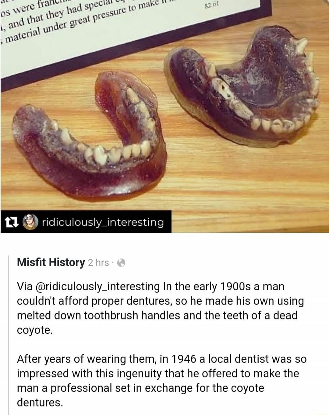 In the early 1900s a man couldn't afford proper dentures, so he made his own using melted down toothbrush handles and the teeth of a dead coyote. After years of wearing them, in 1946 a local dentist was so impressed with this ingenuity that he offered to make the man a professional set in exchange for the coyote dentures.