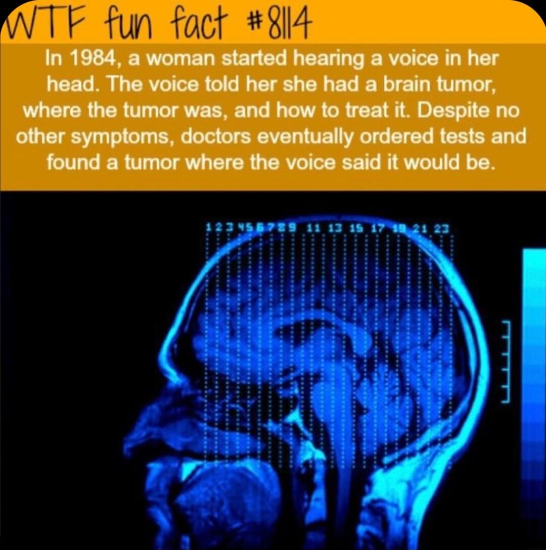 In 1984 a woman started hearing a voice in her head The voice told her she had a brain tumor where the tumor was and how to treat it Despite no other symptoms doctors eventually ordered tests and found a tumor where the voice said it would be