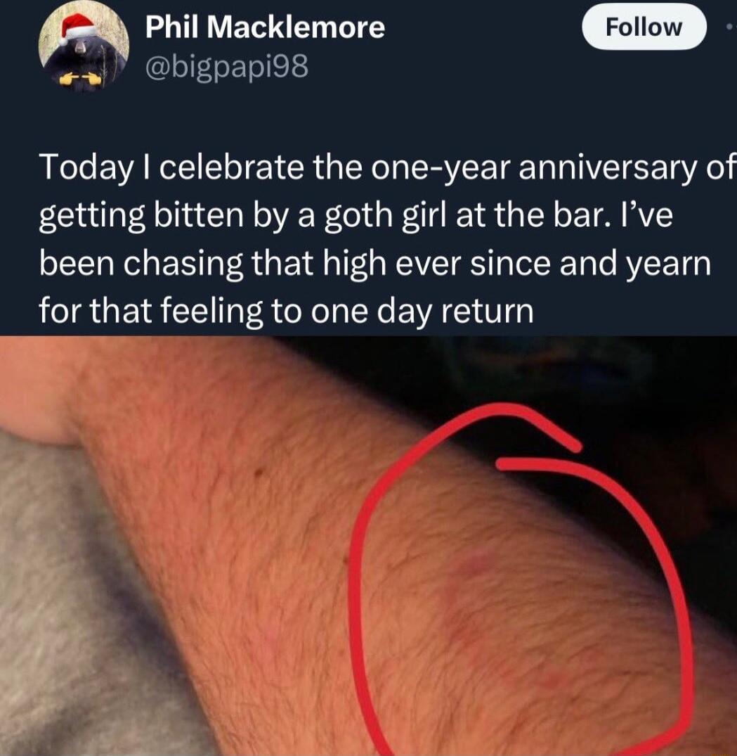 Phil Macklemore i bigpapio8 Today celebrate the one year anniversary of getting bitten by a goth girl at the bar Ive been chasing that high ever since and yearn for that feeling to one day return