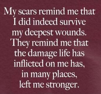 My scars remind me that I did indeed survive my deepest wounds. They remind me that the damage life has inflicted on me has, in many places, left me stronger.