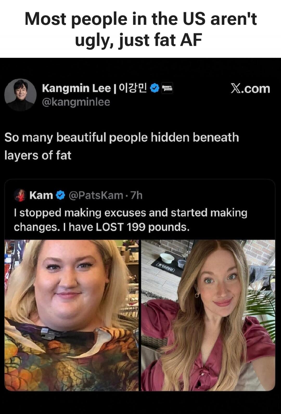 Most people in the US aren't ugly, just fat AF. Kangmin Lee | 이강민 @kangminlee X.com. So many beautiful people hidden beneath layers of fat. Kam @PatsKam · 7h. I stopped making excuses and started making changes. I have LOST 199 pounds.