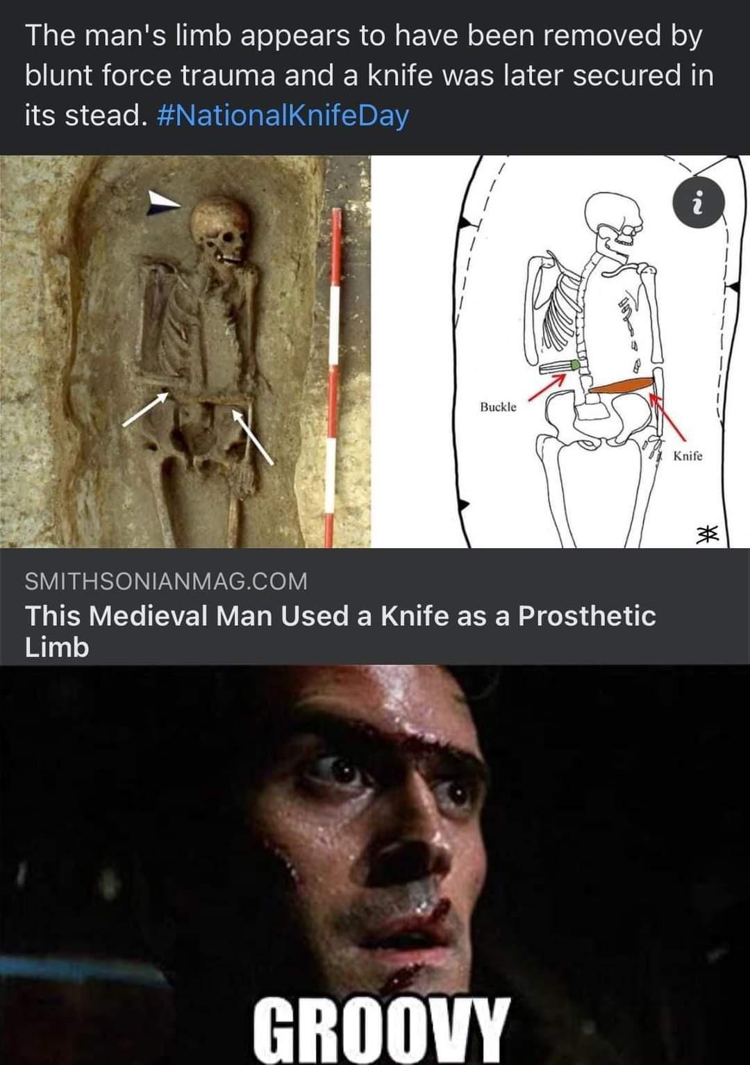 R RN EI R gl ol ol o T 6 oM a EE VLN o LYt g Wl aaloYTe M o blunt force trauma and a knife was later secured in IR F o BNV oo aliIBEY Ay SV BIGIN VNNV eXelelY This Medieval Man Used a Knife as a Prosthetic Limb