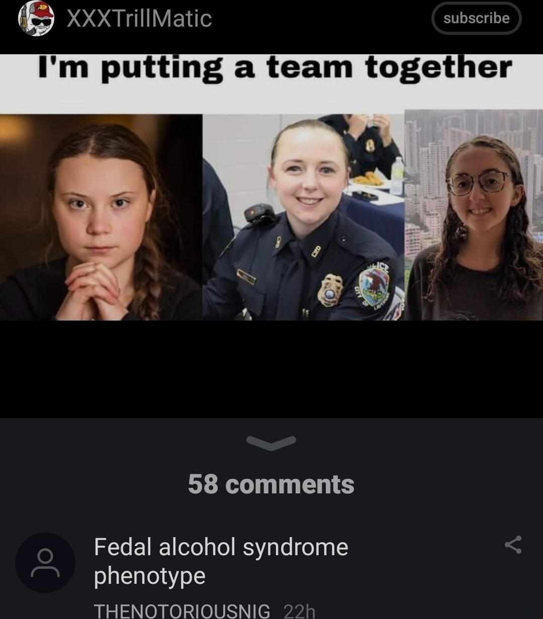 ReeeuilVE subscribe Im putting a team together 58 comments Fedal alcohol syndrome phenotype THENOTORIOUSNIG
