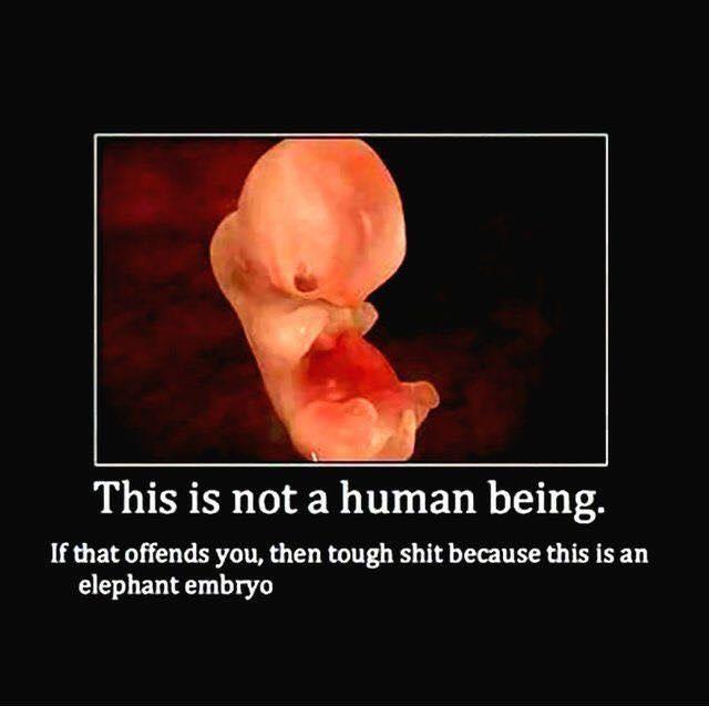 This is not a human being If that offends you then tough shit because this is an elephant embryo