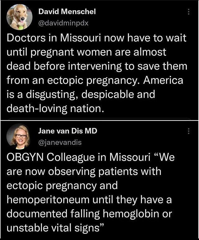 LRV Im davidminpdx Doctors in Missouri now have to wait until pregnant women are almost dead before intervening to save them from an ectopic pregnancy America is a disgusting despicable and EENGR VIR YR 6 Jane van Dis MD GELEVELTIEY OBGYN Colleague in Missouri We are now observing patients with ectopic pregnancy and hemoperitoneum until they have a documented falling hemoglobin or unstable vital s