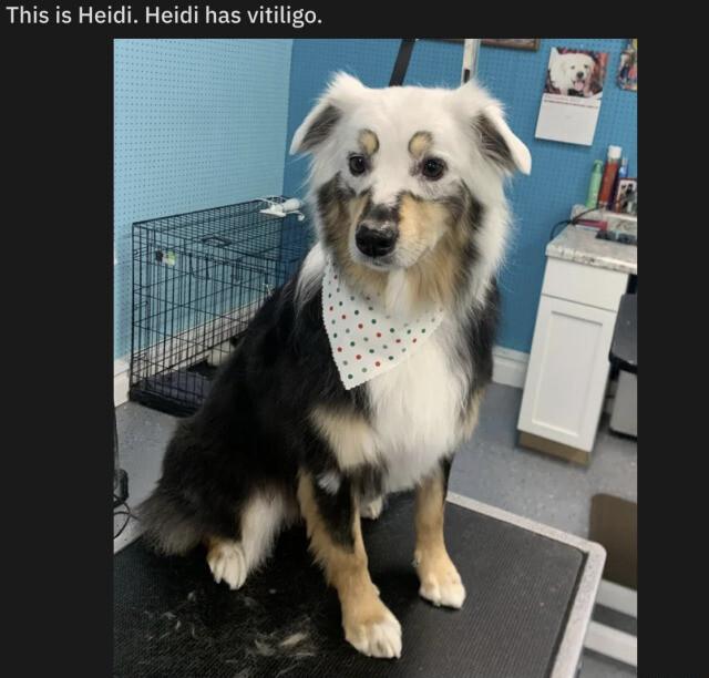 This is Heidi Heidi has vitiligo