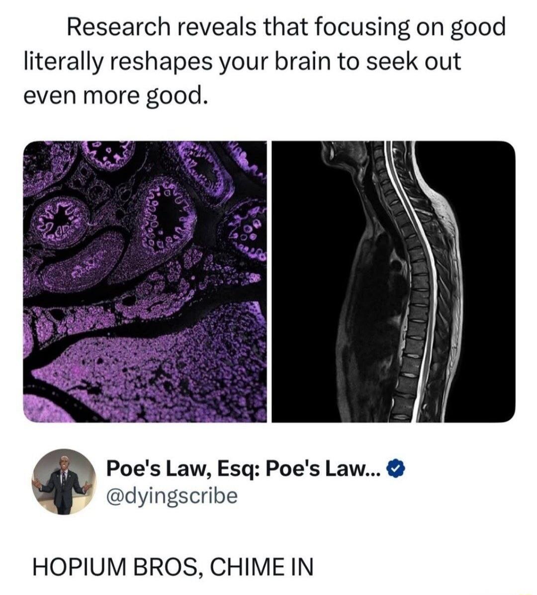 Research reveals that focusing on good literally reshapes your brain to seek out even more good. Poe's Law, Esq: Poe's Law... @dyingscribe HOPUM BROS, CHIME IN