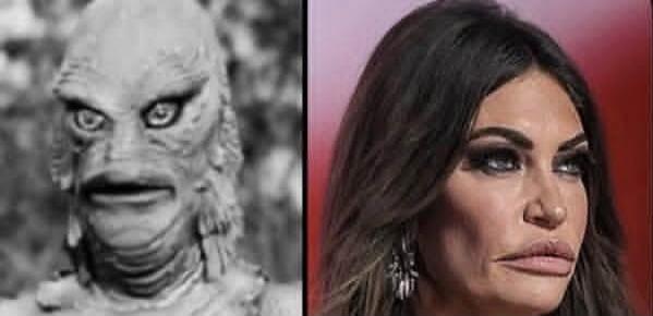 A side-by-side comparison of the Creature from the Black Lagoon and a woman with heavily altered facial features, particularly large lips and prominent cheekbones, suggesting an unnatural appearance.