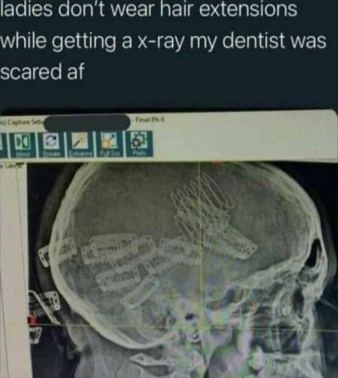 ladies dont wear hair extensions while getting a x ray my dentist was scared af