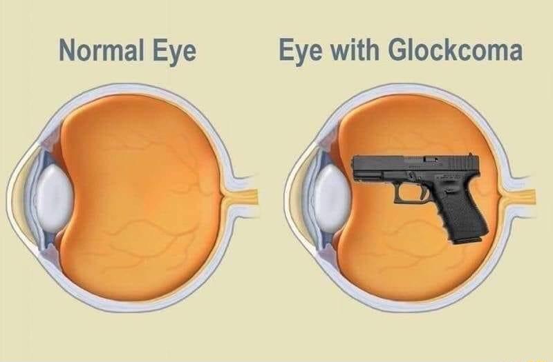 Normal Eye Eye with Glockcoma