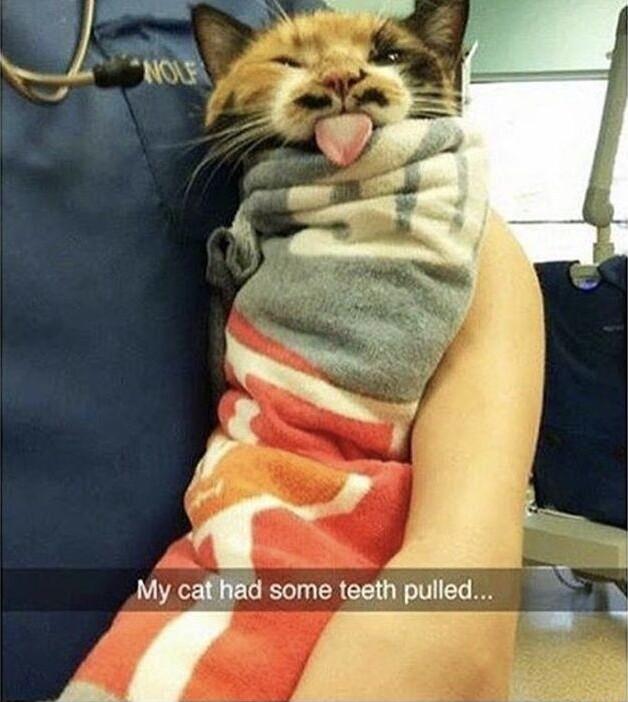 1 71 some teeth pulled r 1