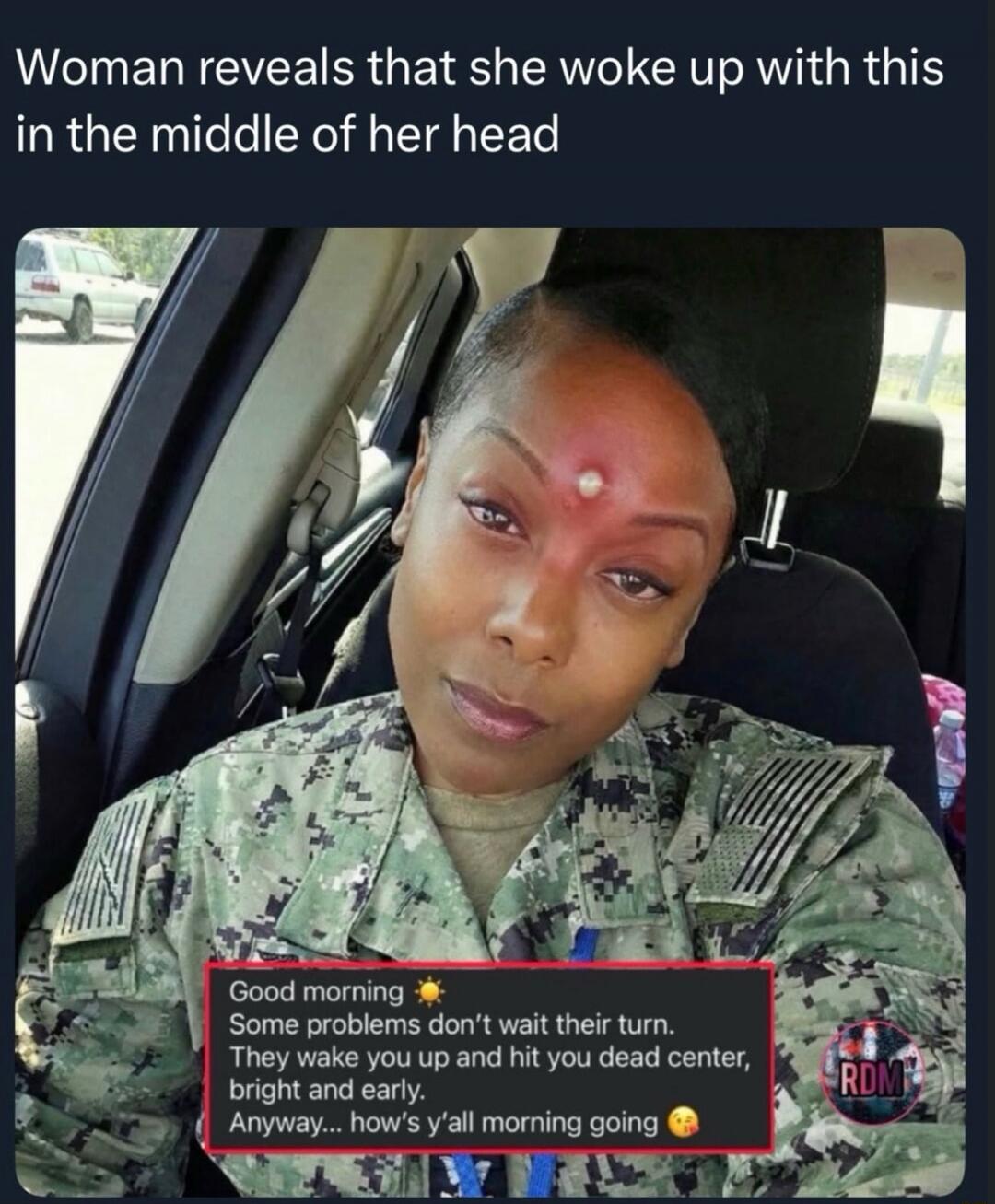 Woman reveals that she woke up with this in the middle of her head
Good morning. Some problems don't wait their turn. They wake you up and hit you dead center, bright and early. Anyway... how's y'all morning going