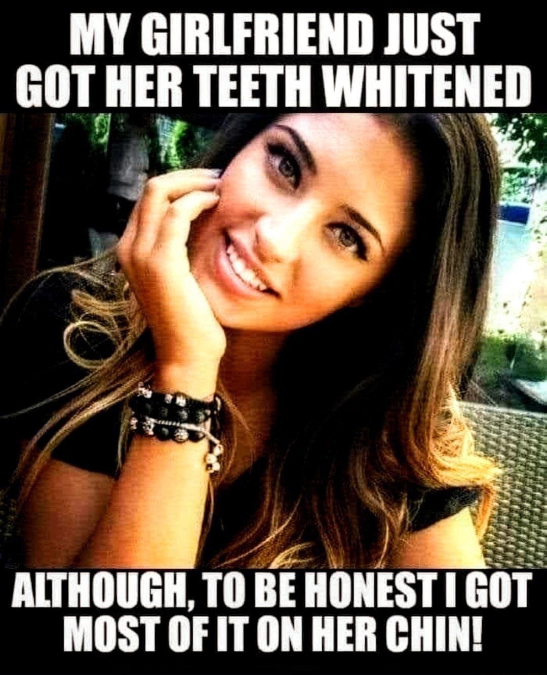 MY GIRLFRIEND JUST GOT HER TEETH WHITENED 3 ALTHOUGH TO BE HONEST I GOT T