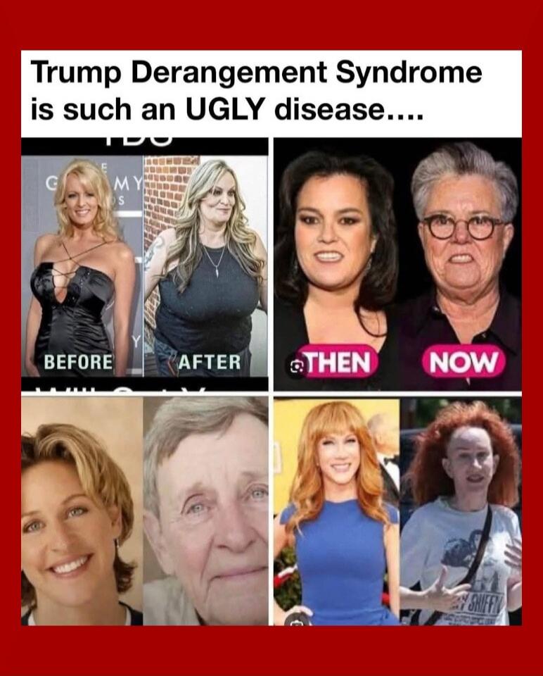Trump Derangement Syndrome is such an UGLY disease.... BEFORE AFTER THEN NOW