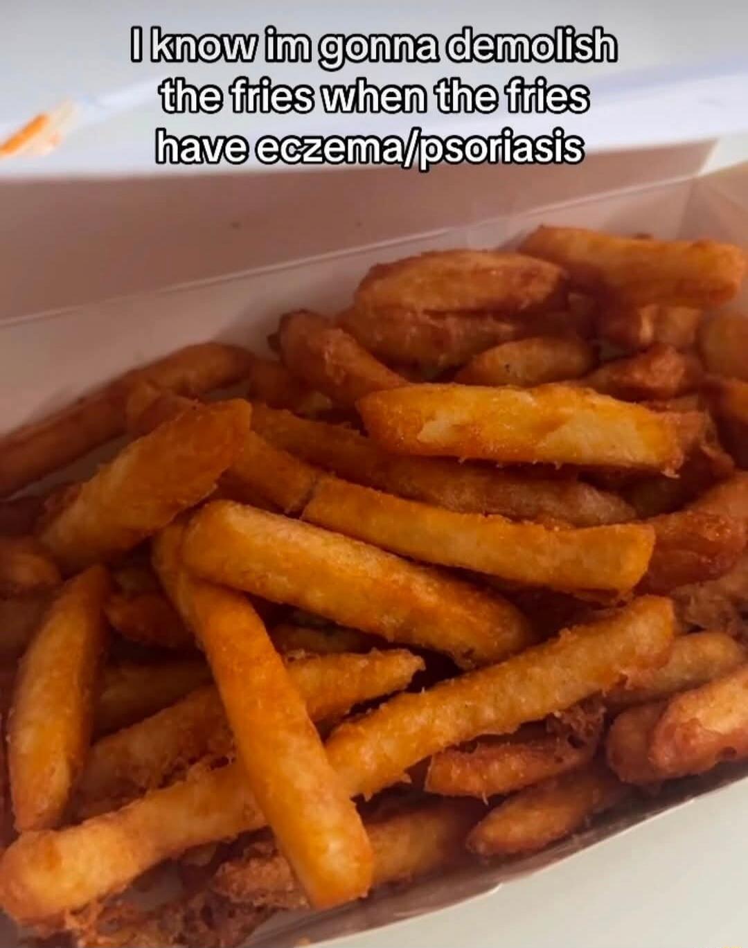 I know im gonna demolish the fries when the fries have eczema/psoriasis