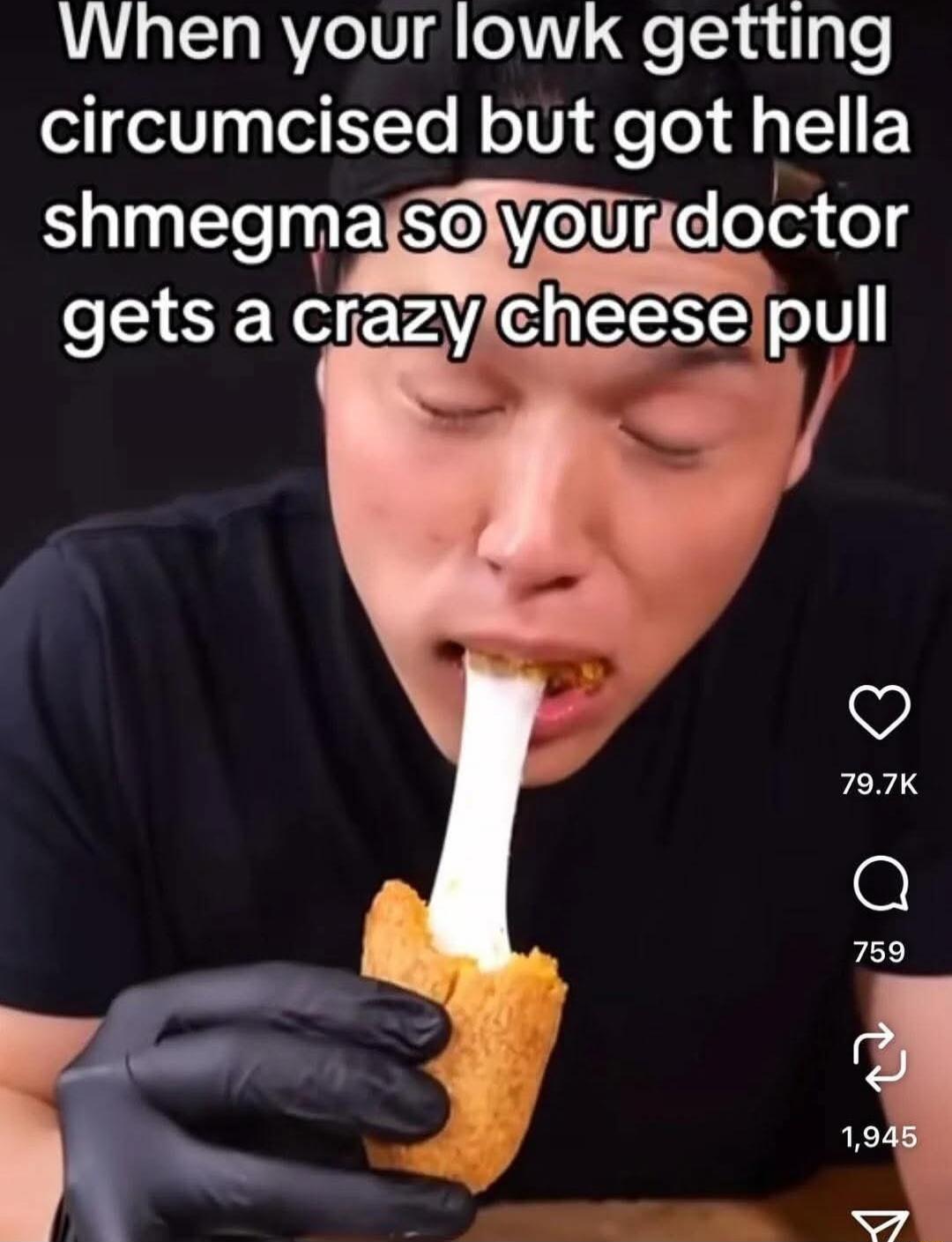 When your lowk getting circumcised but got hella shmegma so your doctor gets a crazy cheese pull