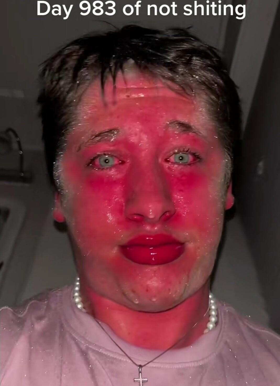 Day 983 of not shiting