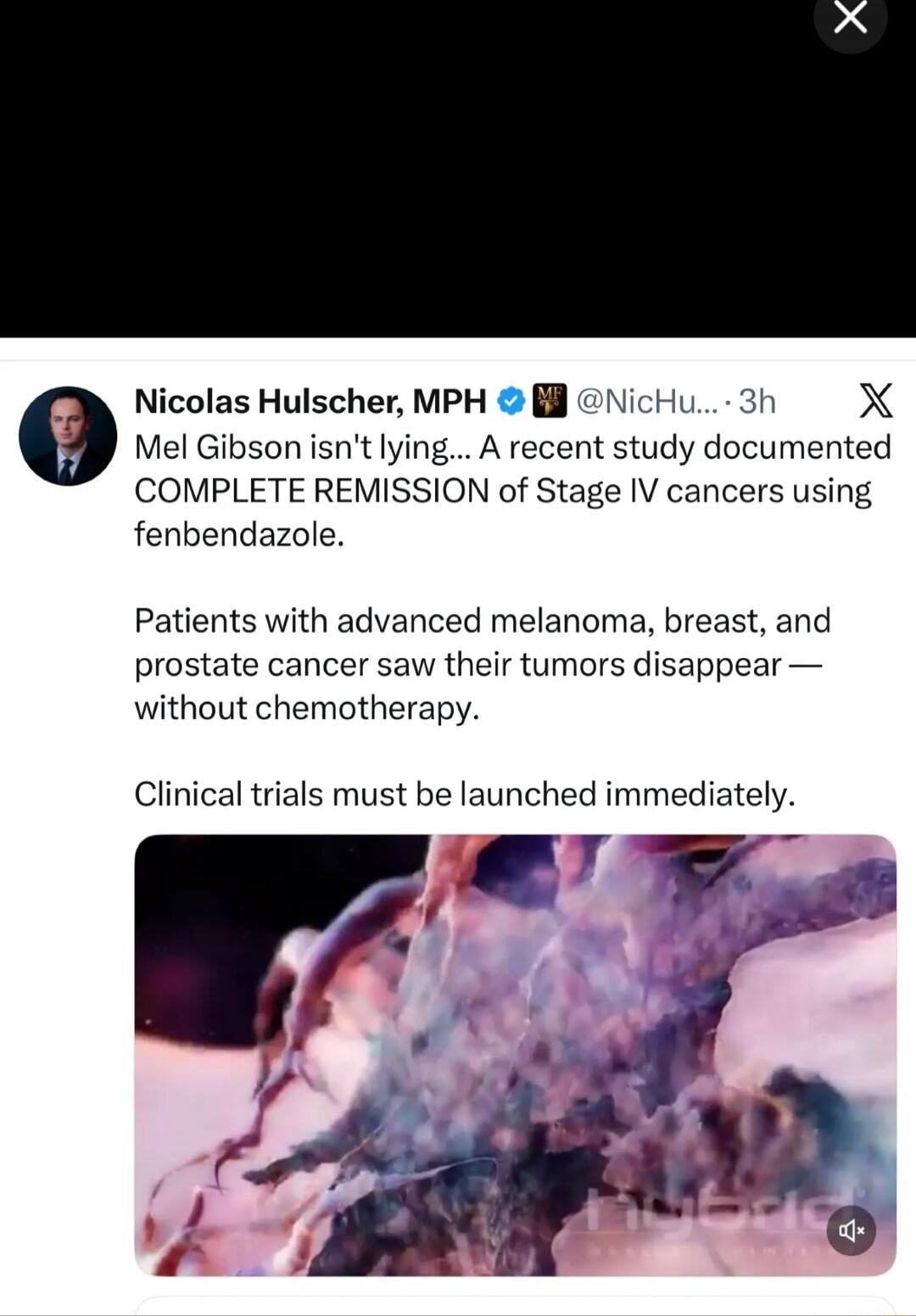 Mel Gibson isn’t lying... A recent study documented COMPLETE REMISSION of Stage IV cancers using fenbendazole. Patients with advanced melanoma, breast, and prostate cancer saw their tumors disappear — without chemotherapy. Clinical trials must be launched immediately.