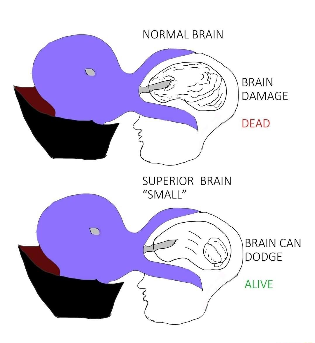 NORMAL BRAIN BRAIN pAmAGE J l DEAD SUPERIOR BRAIN SMALL Vo X BRAIN CAN DODGE
