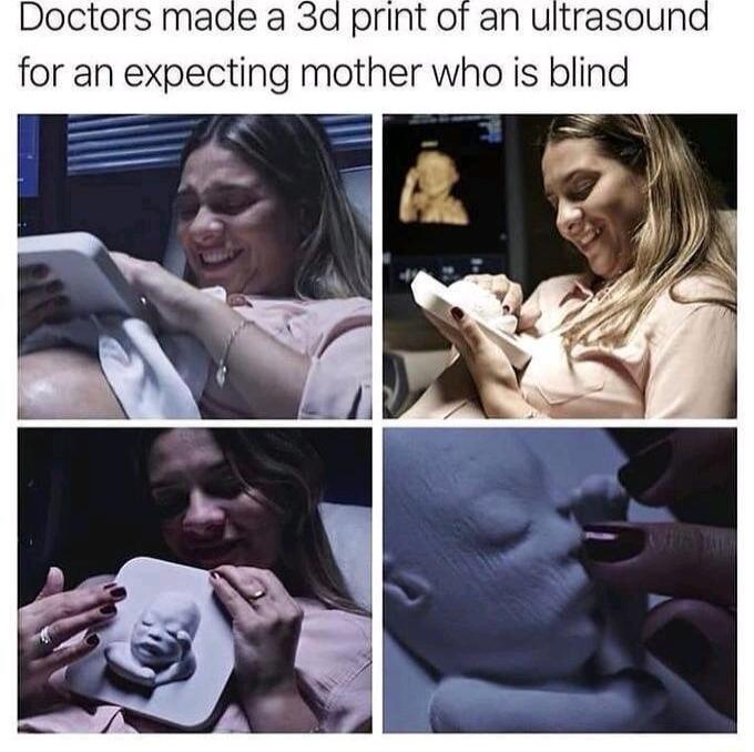 Doctors made a 34 print of an ultrasoun for an expecting mother who is blind