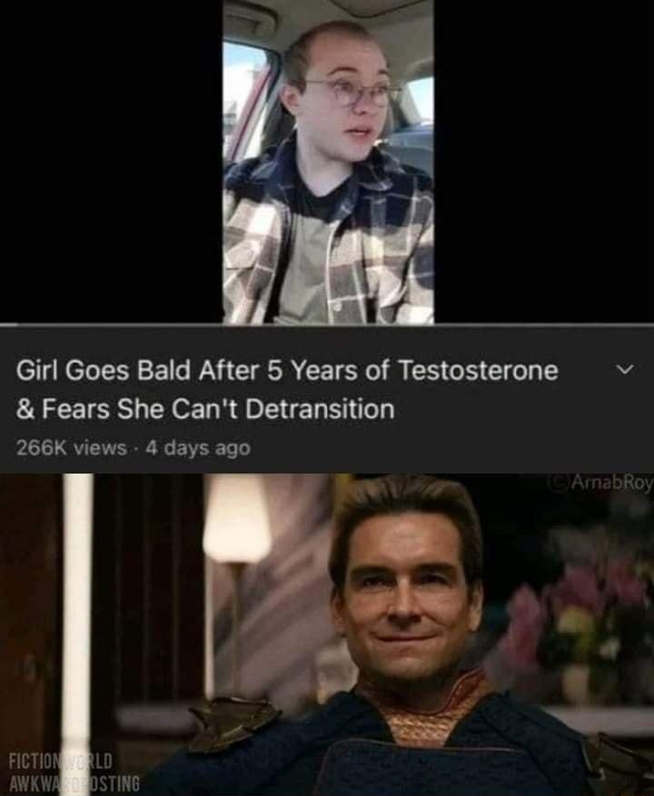 Girl Goes Bald After 5 Years of Testosterone b Fears She Cant Detransition 266K views 4 days ago