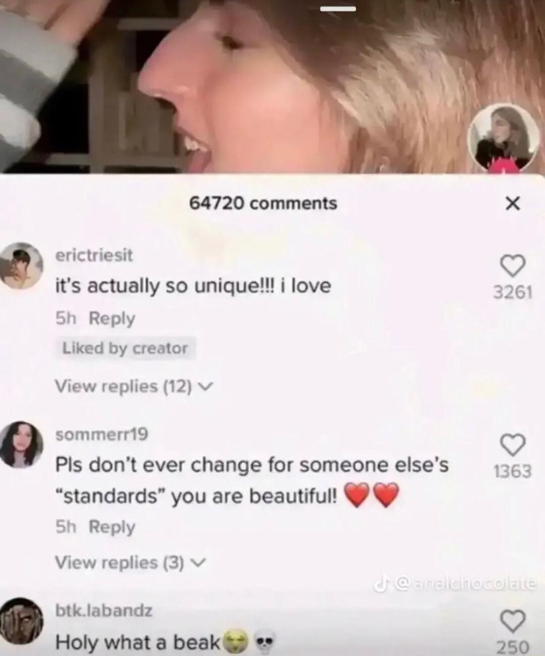 64720 comments erictriesit its actually so unique i love Reply Liked by creator View replies 12 v ommerr19 0 Pis dont ever change for someone elses standards you are beautifull Reply View replies 3 v btk labandz Holy what a beak 250