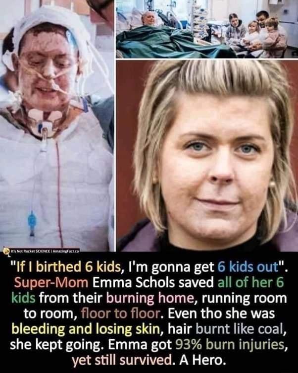 If birthed 6 kids Im gonna get 6 ki per Mom Emma Schols saved all of her 6 kids from their burning home running room to room floor to floor Even tho she was bleeding and losing skin hair burnt like coal she kept going Emma got 93 burn injuries yet still survived A Hero