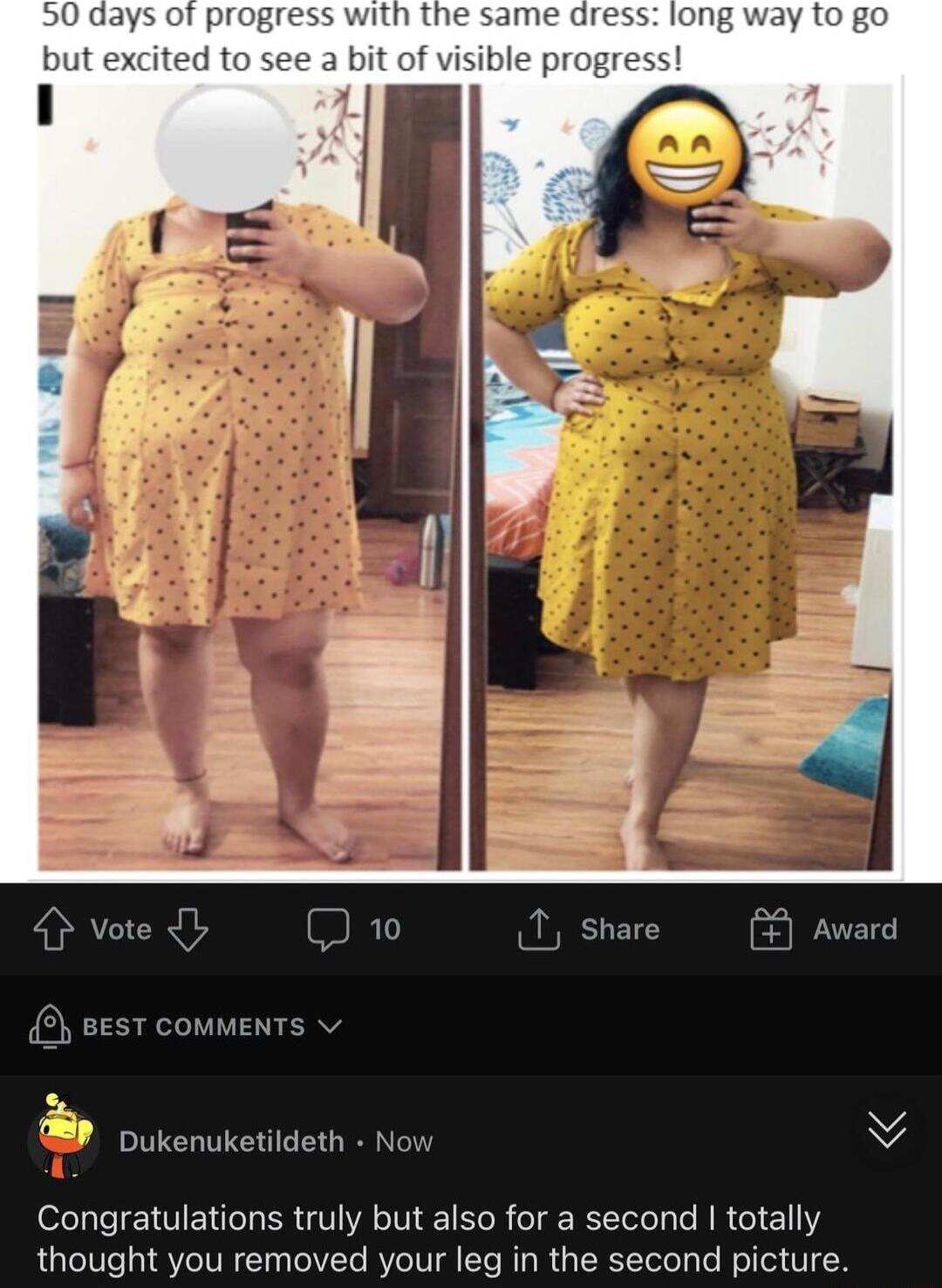 Dukenuketildeth No Y Congratulations truly but also for a second totally thought you removed your leg in the second picture