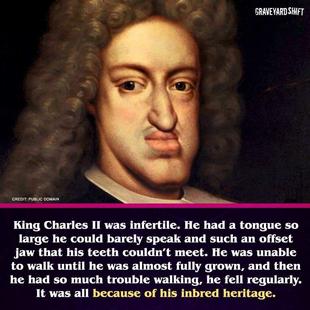 GRAVEYARDSHIFT CREDIT PUBLIC DOMAIN King Charles II was infertile He had a tongue so large he could barely speak and such an offset jaw that his teeth couldnt meet He was unable to walk until he was almost fully grown and then he had so much trouble walking he fell regularly It was all because of his inbred heritage