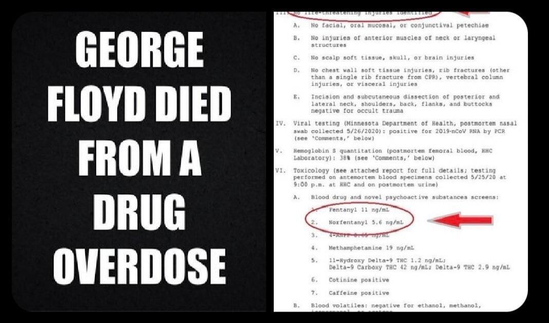 GEORGE FLOYD DIED FROM A DRUG OVERDOSE. VI. Toxicology (see attached report for full details; testing performed on antemortem blood specimens collected 5/25/20 at 9:00 p.m. at HHC and on postmortem urine). A. Blood drug and novel psychoactive substances screens: 1. Fentanyl 11 ng/mL 2. Norfentanyl 5.6 ng/mL. Also present: 4-ANPP 0.65 ng/mL, Methamp
