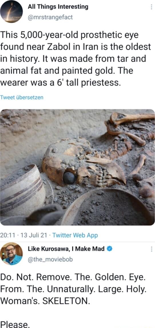 All Things Interesting mrstrangefact This 5000 year old prosthetic eye found near Zabol in Iran is the oldest in history It was made from tar and animal fat and painted gold The wearer was a 6 tall priestess Tweet iibersetzen 2011 13 Juli 21 Twitter Web App Like Kurosawa Make Mad the_moviebob Do Not Remove The Golden Eye From The Unnaturally Large Holy Womans SKELETON Please