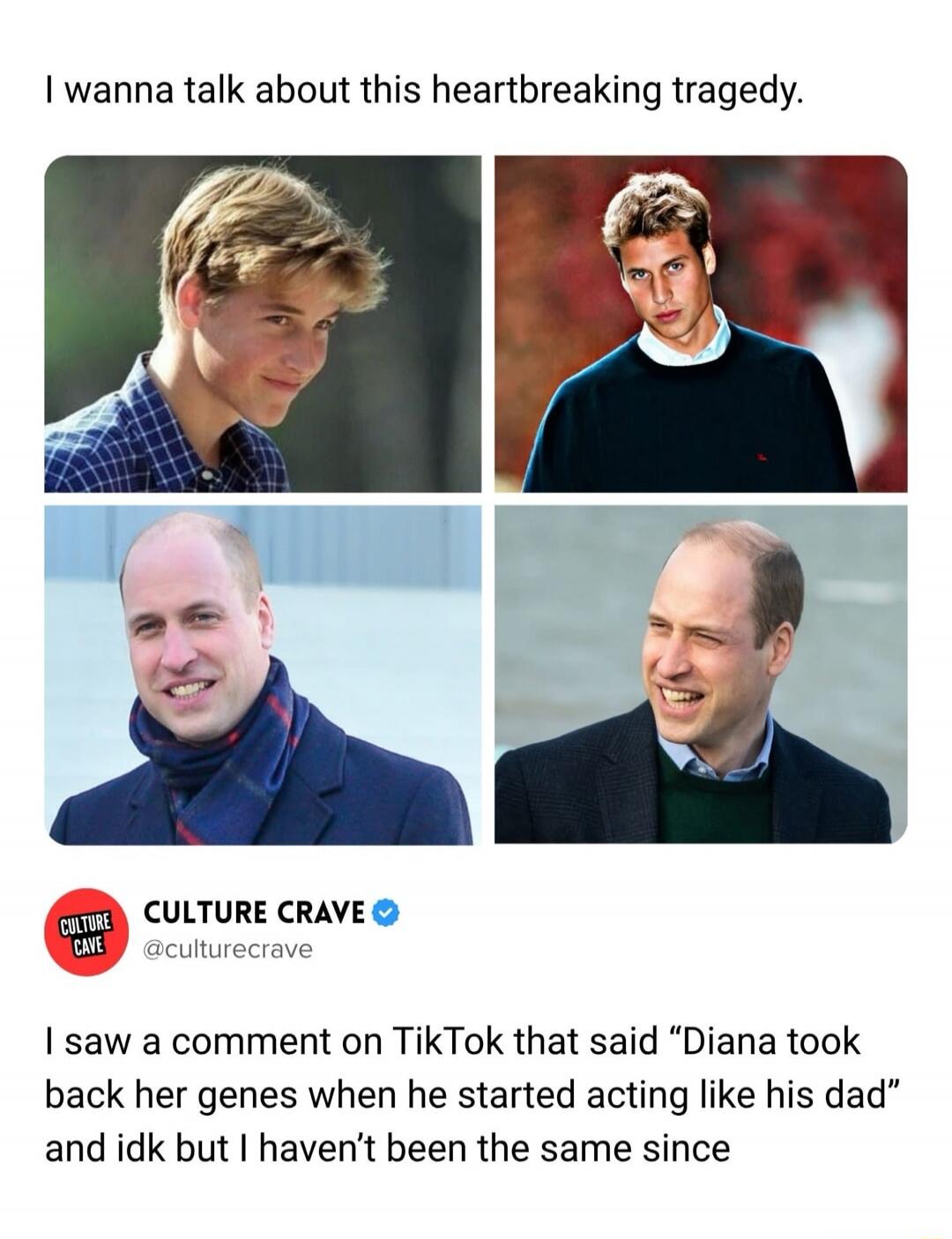 I wanna talk about this heartbreaking tragedy. The image displays four photographs of Prince William, illustrating his appearance from youth with a full head of hair to his current look with significant hair loss. Below the images, a comment from TikTok is quoted: 