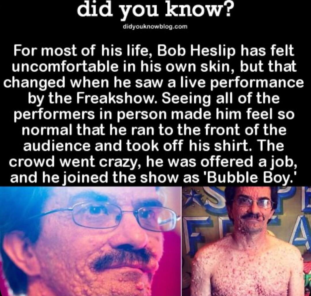 eiloRoli W e le 4 T For most of his life Bob Heslip has felt uncomfortable in his own skin but that changed when he saw a live performance by the Freakshow Seeing all of the performers in person made him feel so LG EIRGE EYEL R GER T F 4 T audience and took off his shirt The crowd went crazy he was offered a job and he joined the show as Bubble Bcy a3