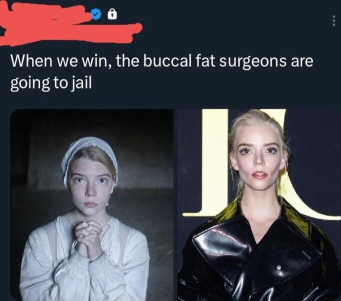 o 6 When we win the buccal fat surgeons are going to jail l X o