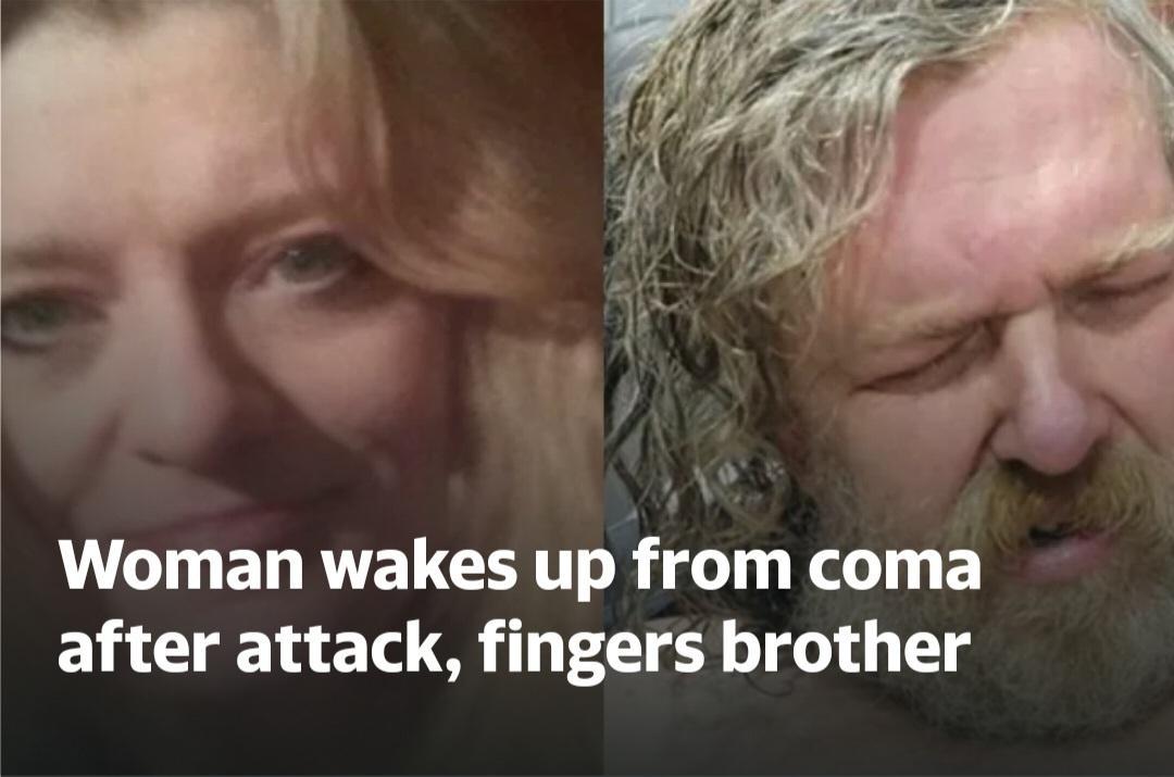 Woman wakes up from coma after attack fingers brother