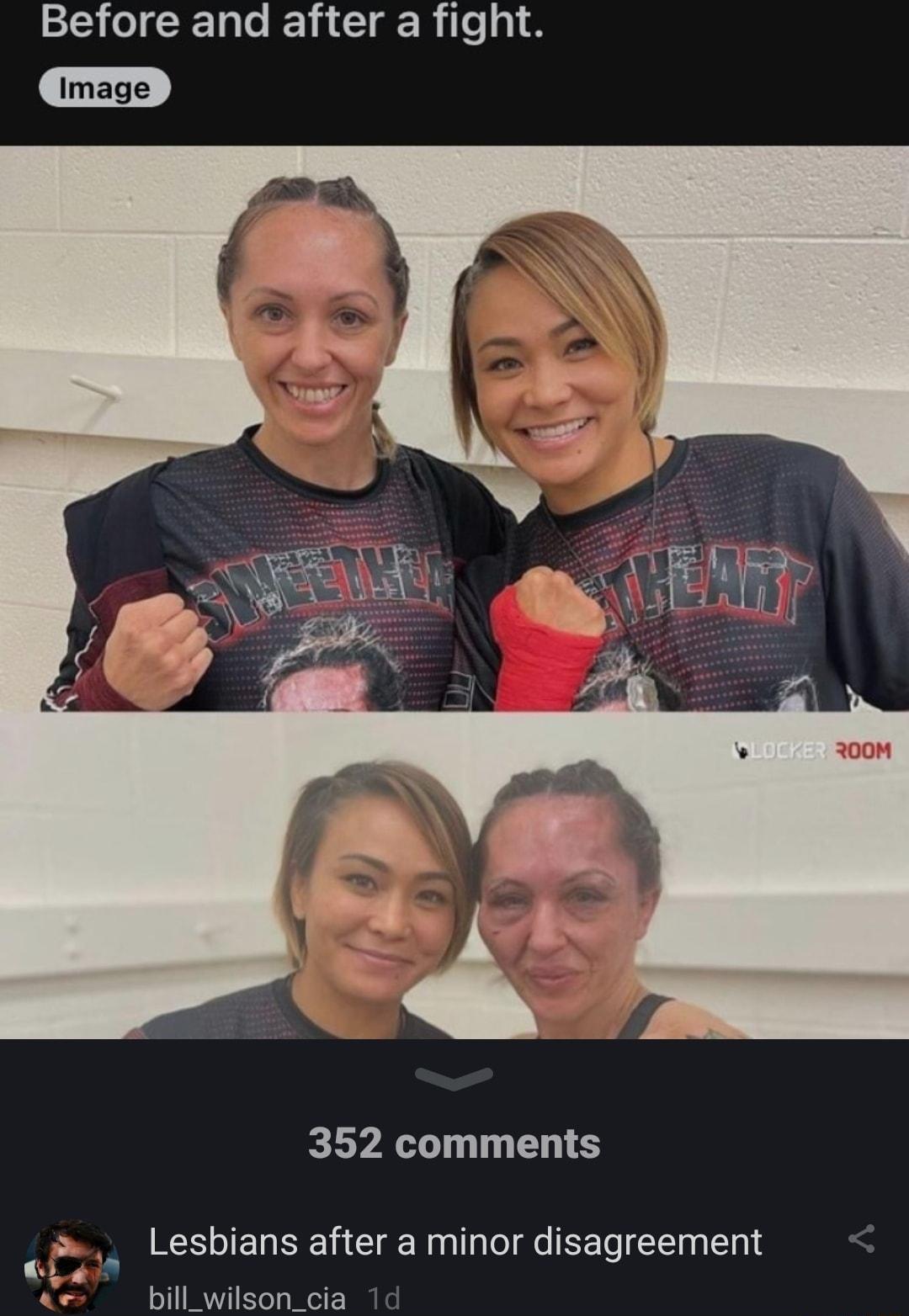 Before and after a fight 352 comments Lesbians after a minor disagreement bill_wilson_cia