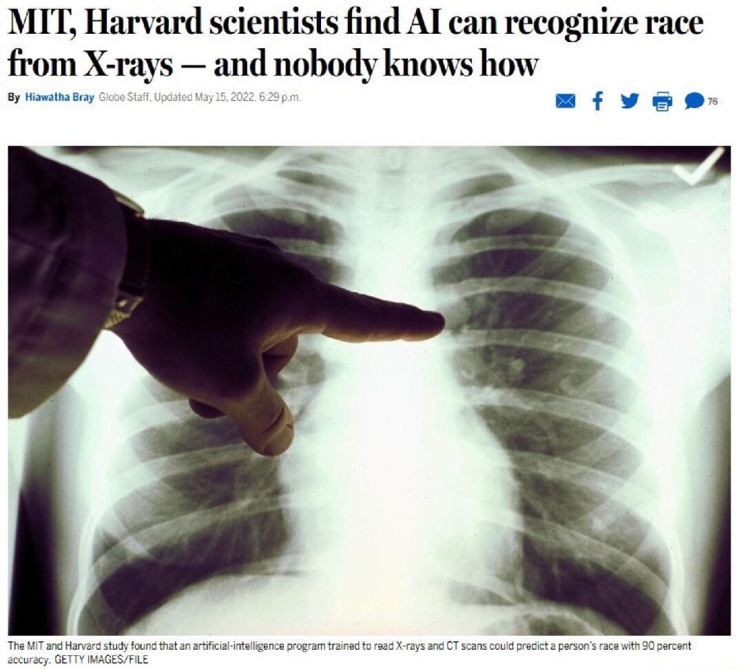 MIT Harvard scientists find AI can recognize race from X rays and nobody knows how oy matra sy mfyvese e